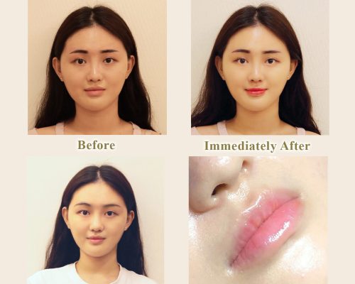 LIPEMBROIDERY-1